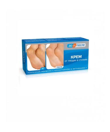 Before and after the legs for the legs from cracks in the feet 50ml