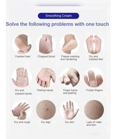 Everything you need Healing cream from cracks on heels exfoliating on the hand - Buy Online on GoSupps.com