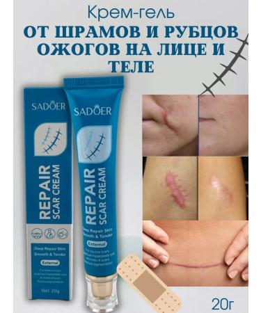 New suite Ointment from scars and scars touched burns on the face and body