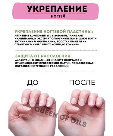 Queen of Oils Serum and oil against the onycholysis of the nail fungus - Buy Online on GoSupps.com