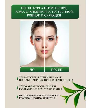 SADOER OFFICIAL Facial serum from acne and acne 30 ml - Buy Online on GoSupps.com