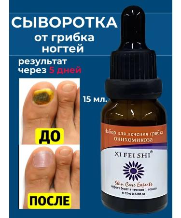 LuNaBeauTy A remedy for nail fungus. Serum from onychomycosis