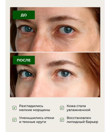 LU MINATE Eye cream from wrinkles - Buy Online on GoSupps.com
