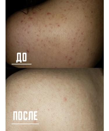 Qualit for the face and body - Buy Online on GoSupps.com