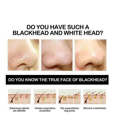 Mask with coal cleans pores deleys black dots - Buy Online on GoSupps.com