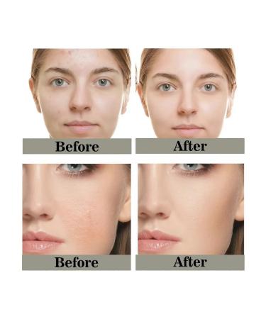 Collagen Mask-Yel 5 pcs - Buy Online on GoSupps.com