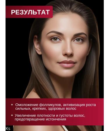 Vitex Serum intensively hair growth activator Pro minxil - Buy Online on GoSupps.com