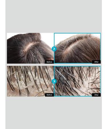 CP1 Scalp scrub - Buy Online on GoSupps.com