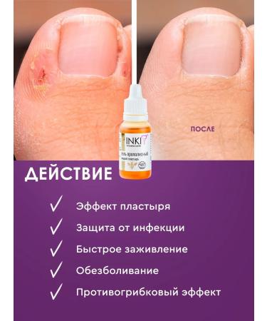 INKI Liquid patch from an ingrown nail cracks and corns - Buy Online on GoSupps.com