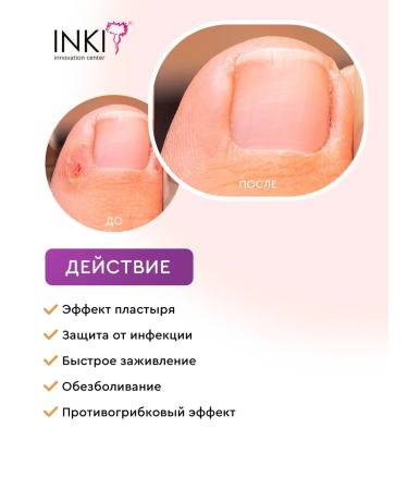 INKI Liquid patch for cracks and corns with an ingrown nail - Buy Online on GoSupps.com
