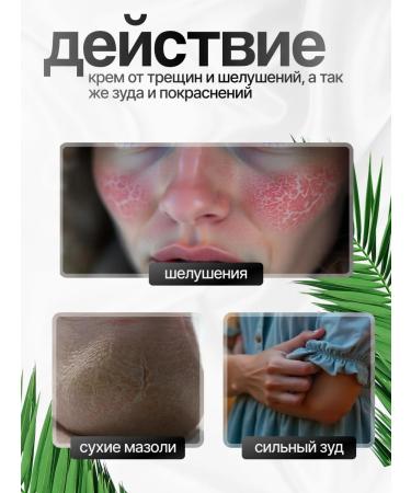 Fu Lie Ling Fulelin cream for very dry skin of the feet with urea for cracks (2 pcs) - Buy Online on GoSupps.com