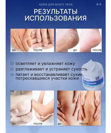 Feet and body cream with urea from cracks and corns 40% - Buy Online on GoSupps.com