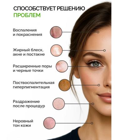 MonoBeauty Cream Salting for problem skin - Buy Online on GoSupps.com