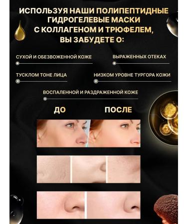 ALLOVEALLURE Korean hydrogel polypeptide masks 5 pcs - Buy Online on GoSupps.com