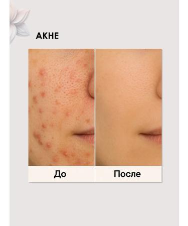 Anua Anti -inflammatory face cream with Hautyunia extract - Buy Online on GoSupps.com