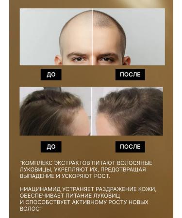 YUNKOMA Shampoo against falling out and for hair growth - Buy Online on GoSupps.com