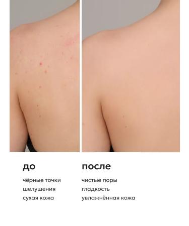 Likato professional Body milk from acne and black dots - Buy Online on GoSupps.com