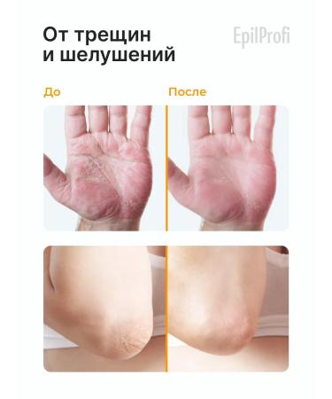 EpilProfi Cream wax for very dry skin legs and the whole body - Buy Online on GoSupps.com
