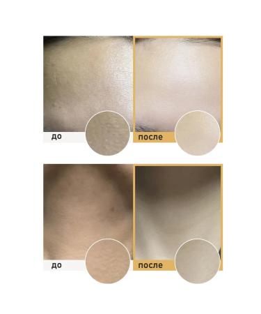 VELLA Cream - night mask against wrinkles on the face and neck 30 pcs - Buy Online on GoSupps.com