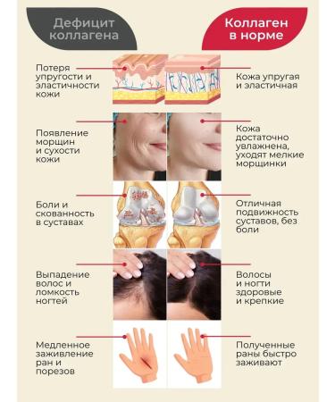 Art by Geba Collagen + lingonberry - Buy Online on GoSupps.com