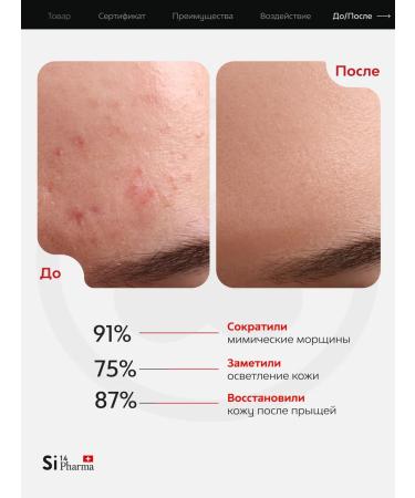 Si14 Pharma Facial serum from wrinkles moisturizing spray 100 ml - Buy Online on GoSupps.com