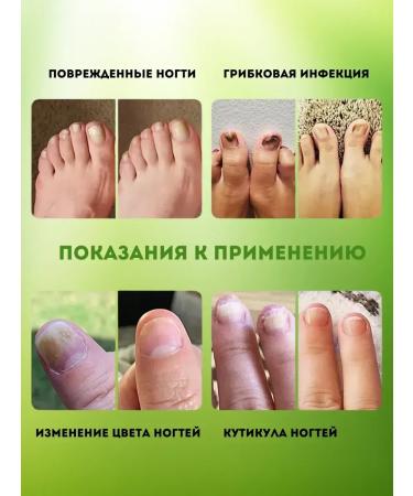 Fleet fungus cream - Buy Online on GoSupps.com