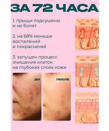 SetSuko Anti-Acne Facial serum from acne - Buy Online on GoSupps.com