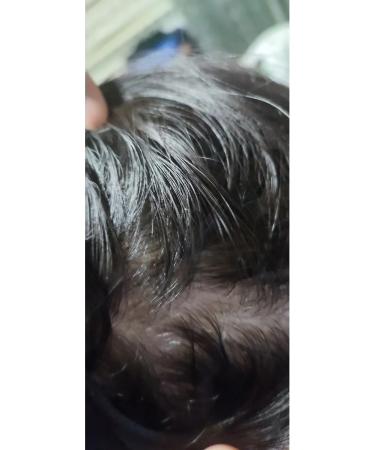 FOR HAIR Anti-hair loss remedy - Buy Online on GoSupps.com