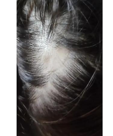 FOR HAIR Infuted serum from hair loss - Buy Online on GoSupps.com
