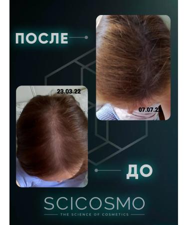SciCosmo A set of 3 oils for hair growth - Buy Online on GoSupps.com