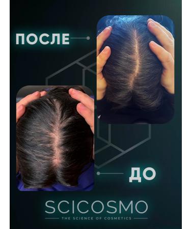 SciCosmo A set of 3 oils for hair growth - Buy Online on GoSupps.com