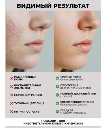 Mesonica Gel for ultrasonic facial cleansing and dezicrustation - Buy Online on GoSupps.com