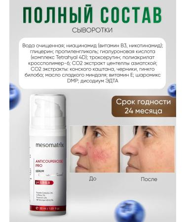 Mesomatrix Professional Cream for meriferosis on the face and serum set 30 ml - Buy Online on GoSupps.com