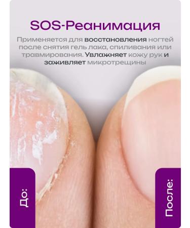 Irisk Professional Crust serum for strengthening and growth of nails and cuticles - Buy Online on GoSupps.com