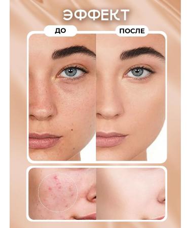 QIC Clae for the face and eyes corrector - Buy Online on GoSupps.com