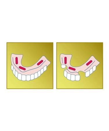 Protefix / Protefix Fixing cream Extra-horsepower aloe vera 47 gr - Buy Online on GoSupps.com