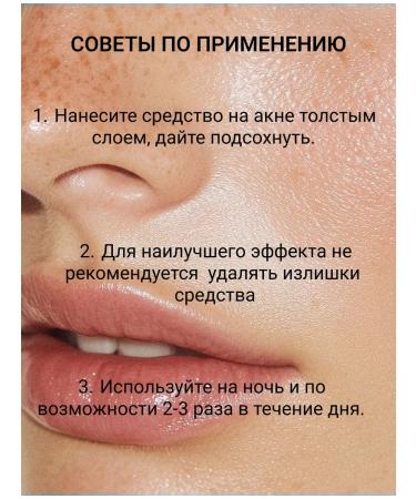 SATIVA Remedy against acne No. 35 point from acne acne - Buy Online on GoSupps.com