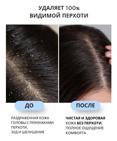 Crimean Pharmacy Shampoo from dandruff with minerals of Lake Saki 31  - Buy Online on GoSupps.com