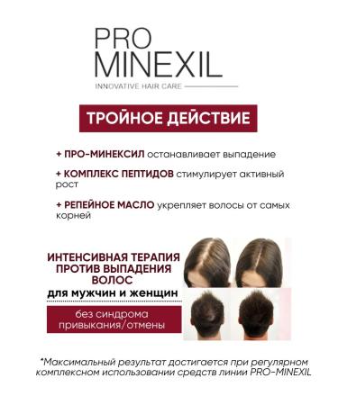 Vitex Intensively balm to strengthen hair Pro minxil - Buy Online on GoSupps.com