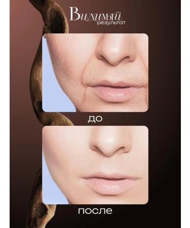 A treasure trove Anti -aging cream with peptides of red caviar - Buy Online on GoSupps.com