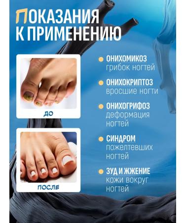 Traditional Chinese Medicine Ointment from nail fungus on the legs 2 pieces cream against the fungus - Buy Online on GoSupps.com