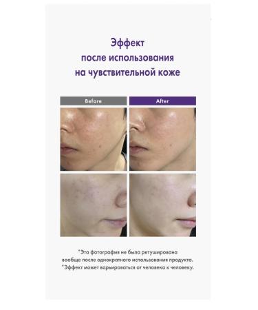 BeHope Calm -moisturizer Vegan - Buy Online on GoSupps.com