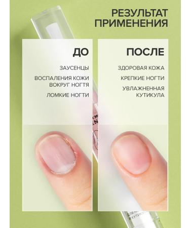 FRENCH Set oil pencil for nails and cuticles 2pcs - Buy Online on GoSupps.com