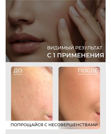 Immunoskin Moisturizing face cream with cramids - Buy Online on GoSupps.com