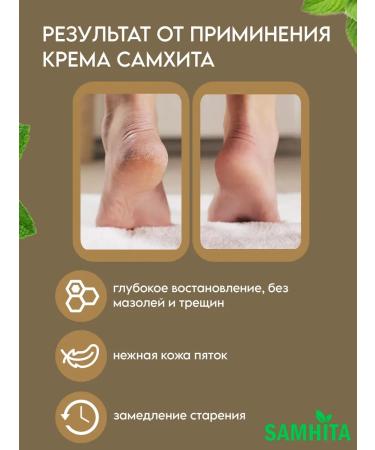 Samhita Cream for heels 4 pcs. 25 g - Buy Online on GoSupps.com
