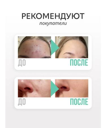 BIELENDA DR Medica Acne Lotion from acne tonic 250 ml - Buy Online on GoSupps.com