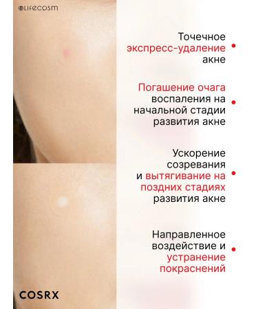 Cosrx Hydrocoloid patches of parsing parsing - Buy Online on GoSupps.com