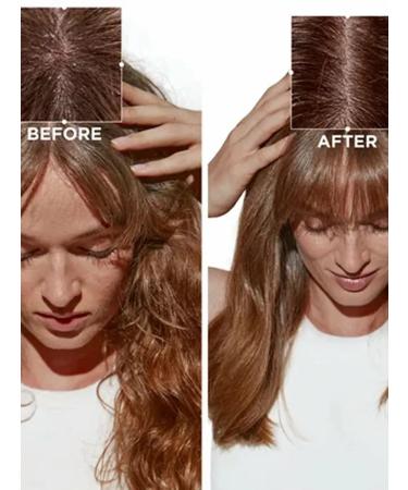 Kerastase Symbiose Micro-Exfolating scrub for scalp 200 ml - Buy Online on GoSupps.com