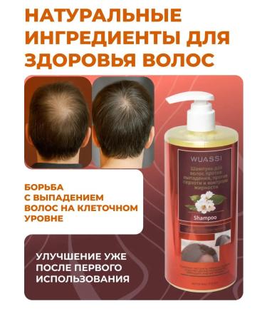 TopStore99 Shampoo against hair loss and oily - Buy Online on GoSupps.com