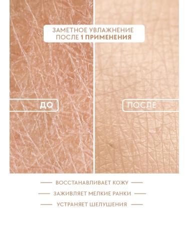 EVSI Moisturizing hand cream with urea - Buy Online on GoSupps.com